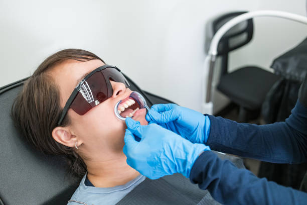 Best Knocked-Out Tooth (Avulsed Tooth) Treatment in Glasgow, DE